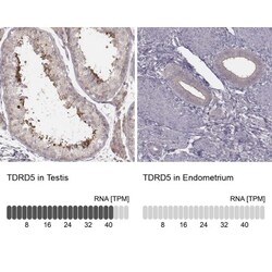 TDRD5 Antibody, Novus Biologicals 25 &mu;L; Unlabeled:Antibodies, Polyclonal